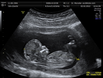 Announcing your pregnancy via HorN submissions